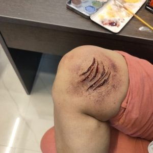 Animal Cuts and Bites